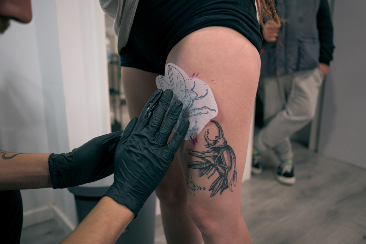 Tattoo-Removal-clinic-in-New-Town-Kolkata